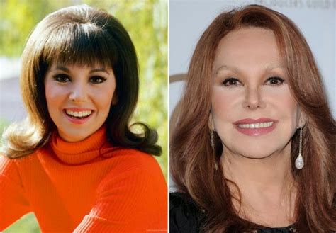 What happened to marlo thomas nose. Things To Know About What happened to marlo thomas nose. 